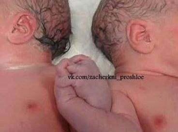 Фото заслуживает миллион слов . 14 мая в Барселоне,родились близнецы.Вся больница сбежалась ,увидеть незабываемую картину.Руки близнецов переплетались.Это прекрасный жест, чтобы запомнить навсегда!!!